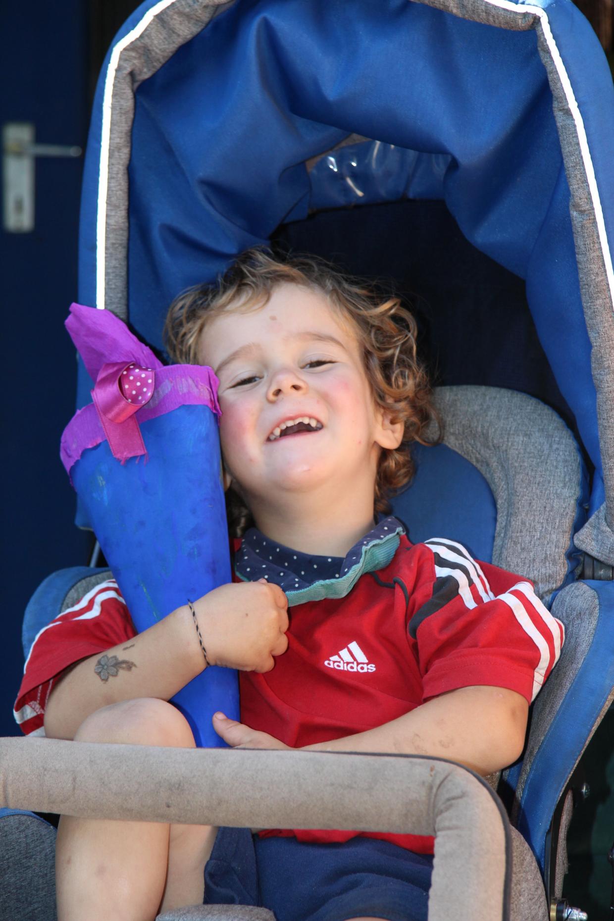 Mattis (4) aus Gottenheim hat einen seltenen Genfehler - Regenbogen